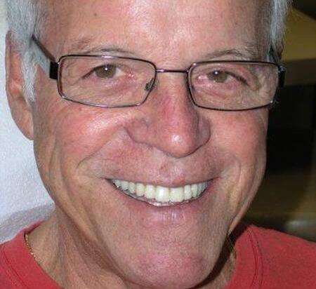 La Mesa dentures patient model smiling