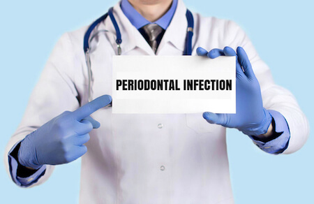 what is periodontal disease